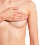 What to Expect from a Breast Lift Surgery in Turkey?