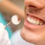 Dental Crown Process