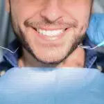 Цена на ласерско белеење на заби во Истанбул, Турција - Преуредување насмевка