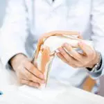 Best Knee Replacement Surgery in Europe - Best Price