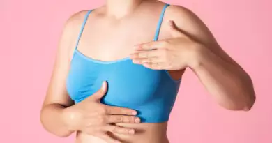 ¿Cuánto cuesta un levantamiento de senos? Cirugía exitosa de levantamiento de senos en Turquía Fotos de antes y después